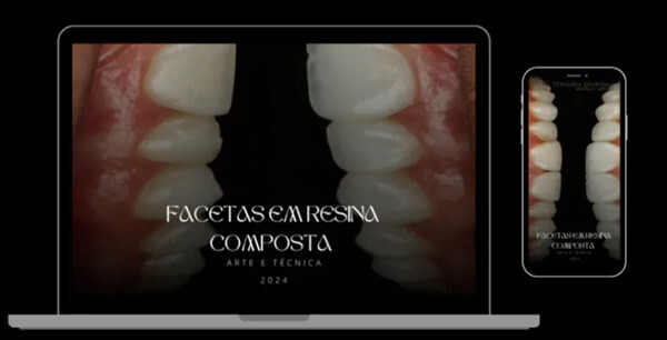 Ebook Facetas em Resina