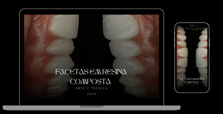 Ebook Facetas em Resina